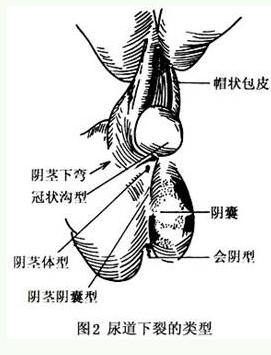 生殖整形