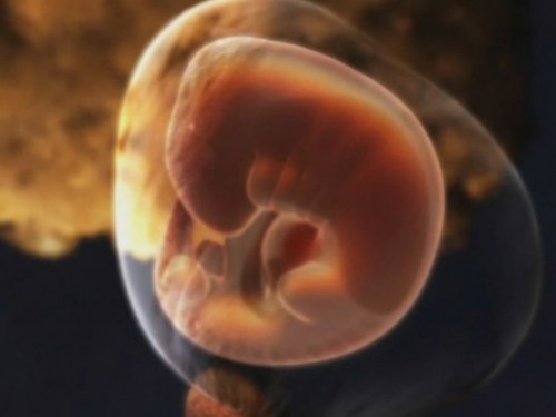 怀孕5个月胎儿图 男孩图片